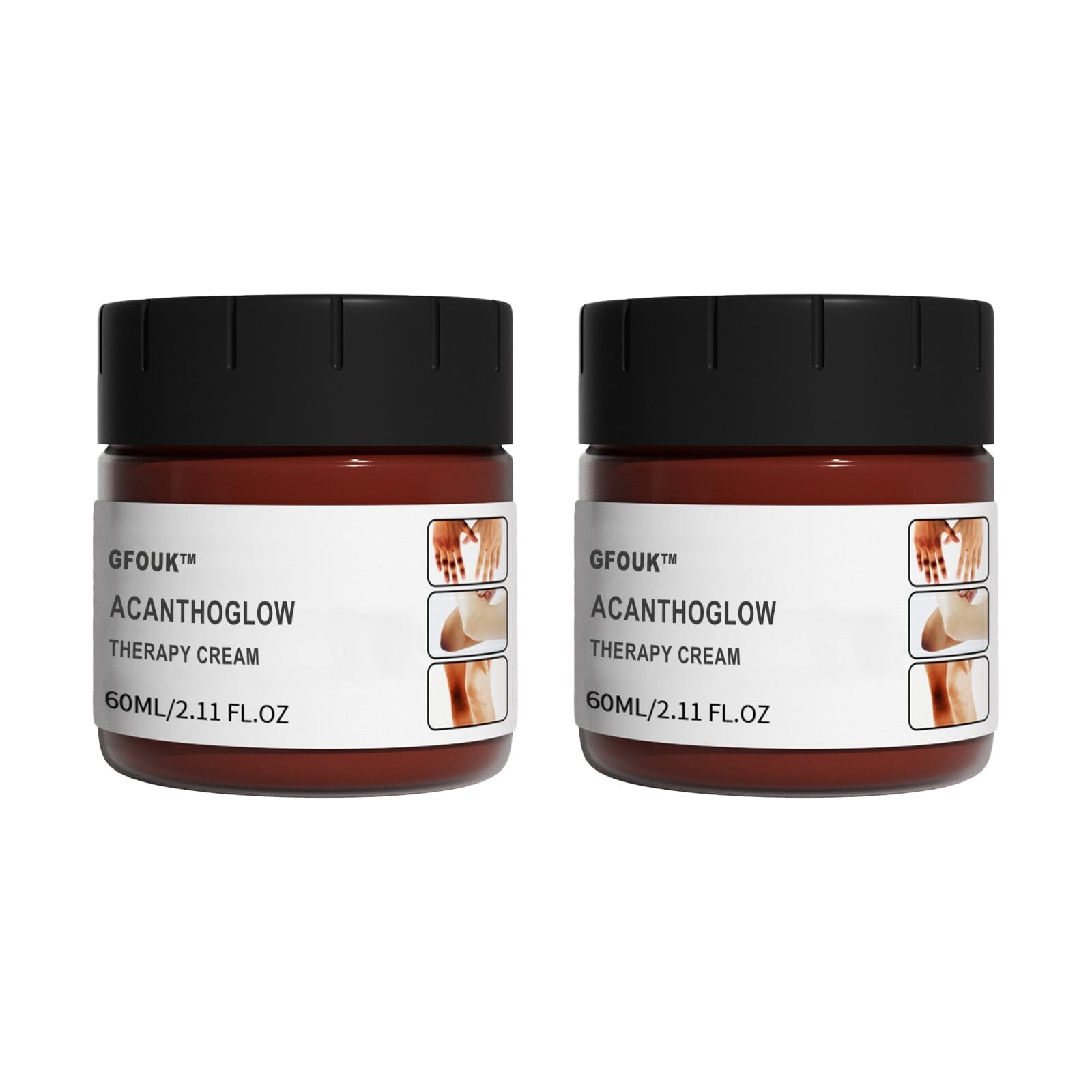 GFOUK™ AcanthoGlow Therapy Cream 1688 2PCS USD29.97 ❤️50% OFF❤️ 