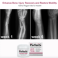 GFOUK™ Perfectx Joint And Bone Therapy Cream KJ YXKJ9999-0379 