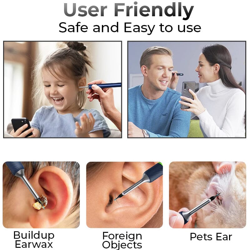 GFOUK™ WiFi 1080HD Visible Earwax Remover DS 1688 