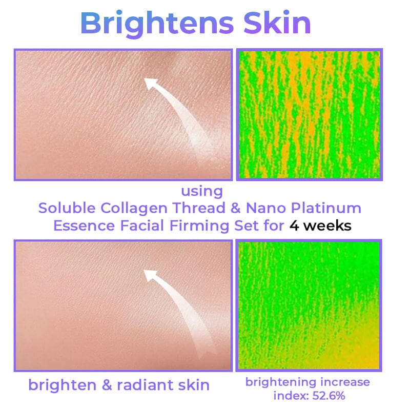 Soluble Collagen Thread & Nano Platinum Essence Facial Firming Set JC 1688 
